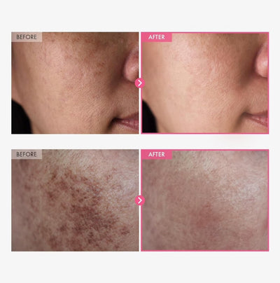 Hikari Advanced Arbutin Brightening Cream