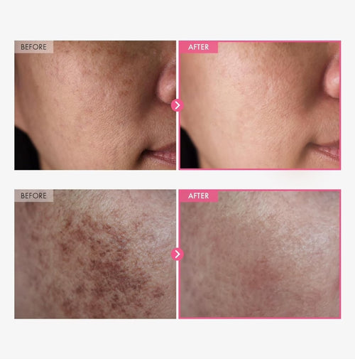 Hikari Advanced Arbutin Brightening Cream